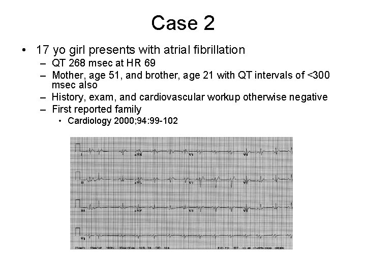 Case 2 • 17 yo girl presents with atrial fibrillation – QT 268 msec