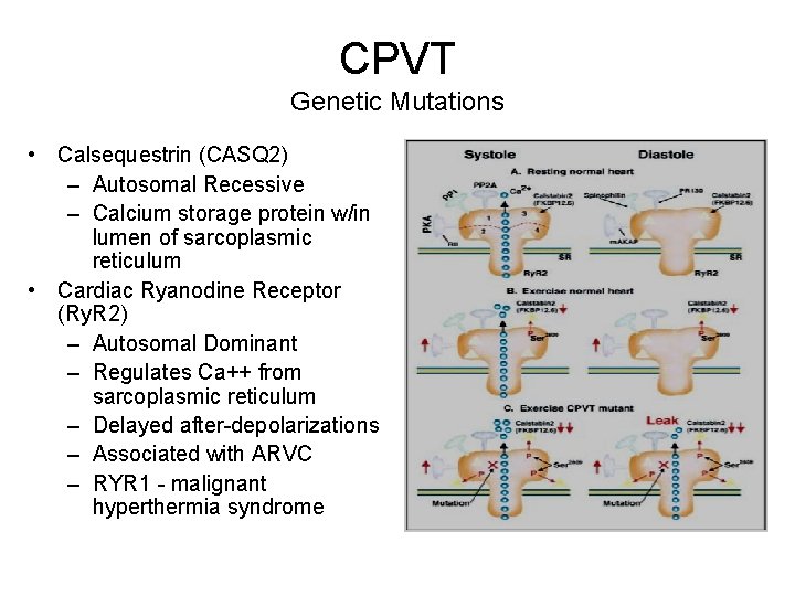 CPVT Genetic Mutations • Calsequestrin (CASQ 2) – Autosomal Recessive – Calcium storage protein