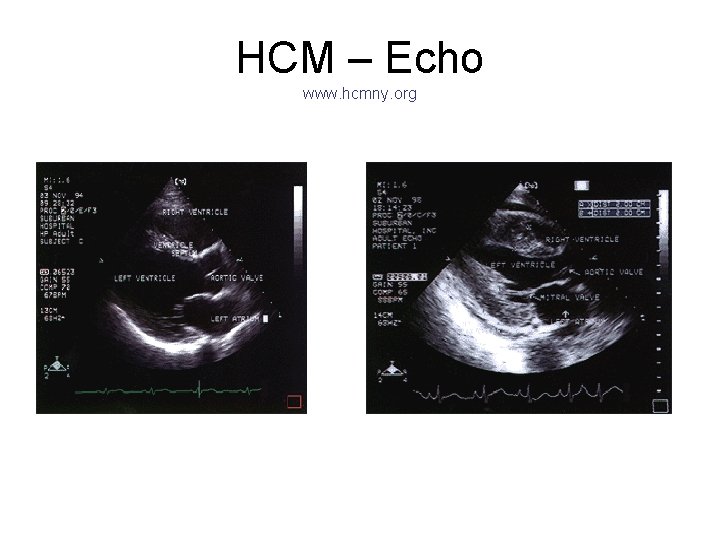 HCM – Echo www. hcmny. org 