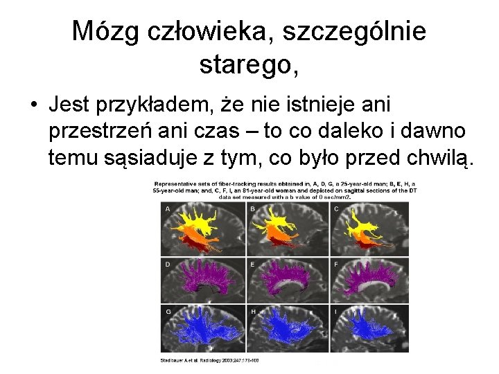 Mózg człowieka, szczególnie starego, • Jest przykładem, że nie istnieje ani przestrzeń ani czas