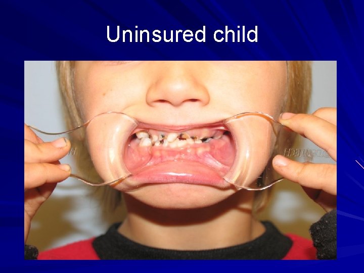 Uninsured child 