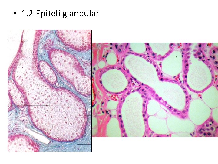 • 1. 2 Epiteli glandular • 1. 2 Epiteli glandular