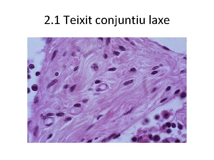 2. 1 Teixit conjuntiu laxe 2. 1 Teixit conjuntiu laxe