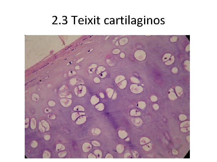 2. 3 Teixit cartilaginos 2. 3 Teixit cartilaginos