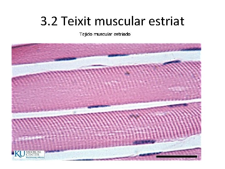3. 2 Teixit muscular estriat 3. 2 Teixit muscular estriat