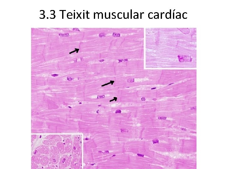 3. 3 Teixit muscular cardíac 3. 3 Teixit muscular cardíac