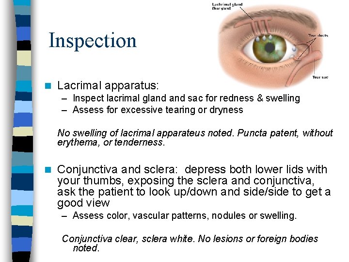Inspection n Lacrimal apparatus: – Inspect lacrimal gland sac for redness & swelling –
