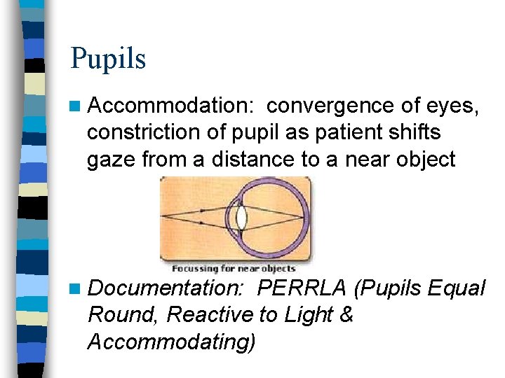 Pupils n Accommodation: convergence of eyes, constriction of pupil as patient shifts gaze from