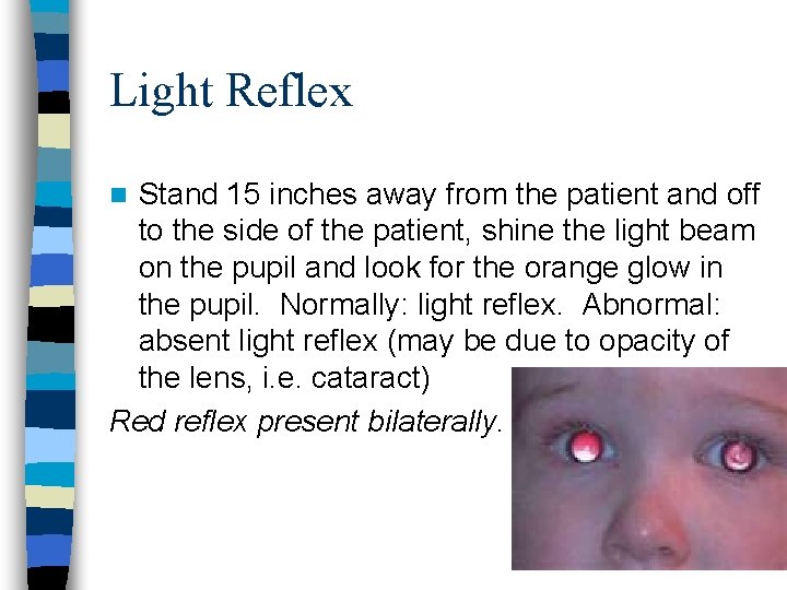 Light Reflex Stand 15 inches away from the patient and off to the side