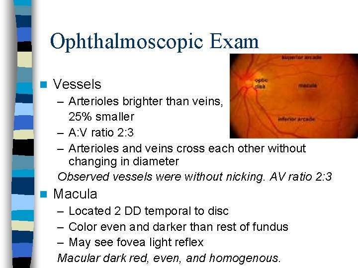 Ophthalmoscopic Exam n Vessels – Arterioles brighter than veins, 25% smaller – A: V