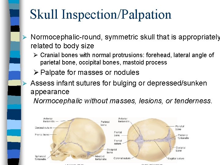 Skull Inspection/Palpation Ø Normocephalic-round, symmetric skull that is appropriately related to body size Ø