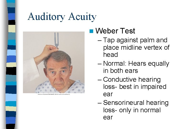 Auditory Acuity n Weber Test – Tap against palm and place midline vertex of