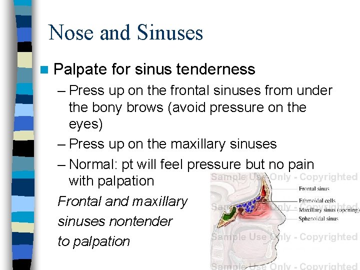 Nose and Sinuses n Palpate for sinus tenderness – Press up on the frontal