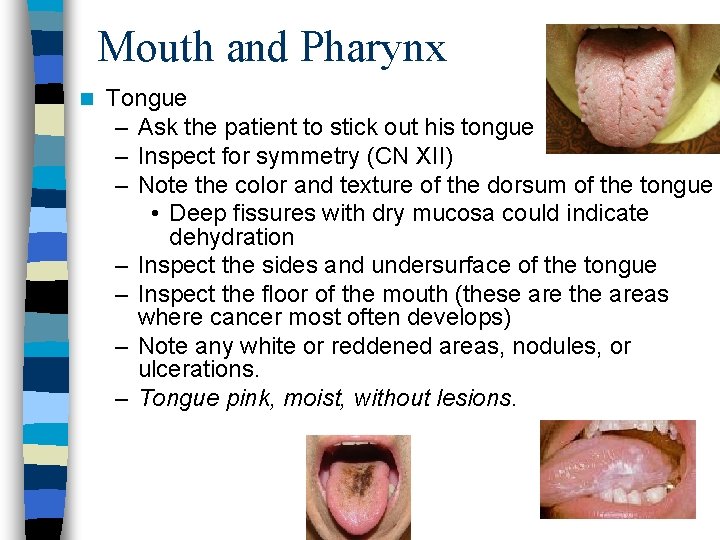 Mouth and Pharynx n Tongue – Ask the patient to stick out his tongue