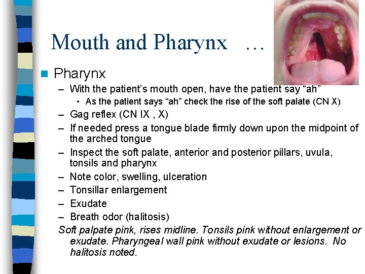 Mouth and Pharynx … n Pharynx – With the patient’s mouth open, have the