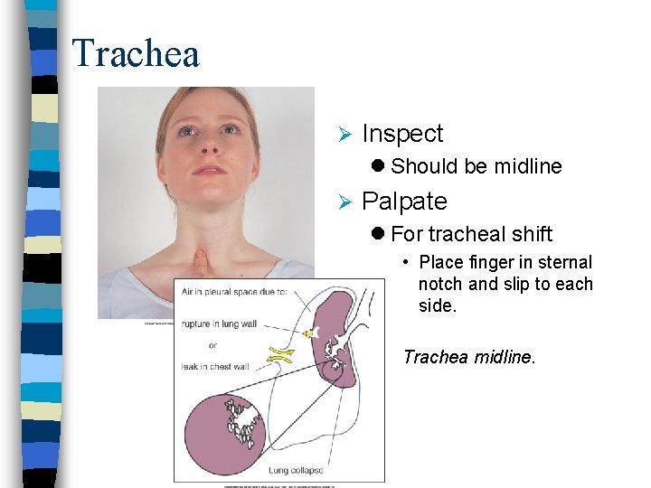 Trachea Ø Inspect l Should be midline Ø Palpate l For tracheal shift •