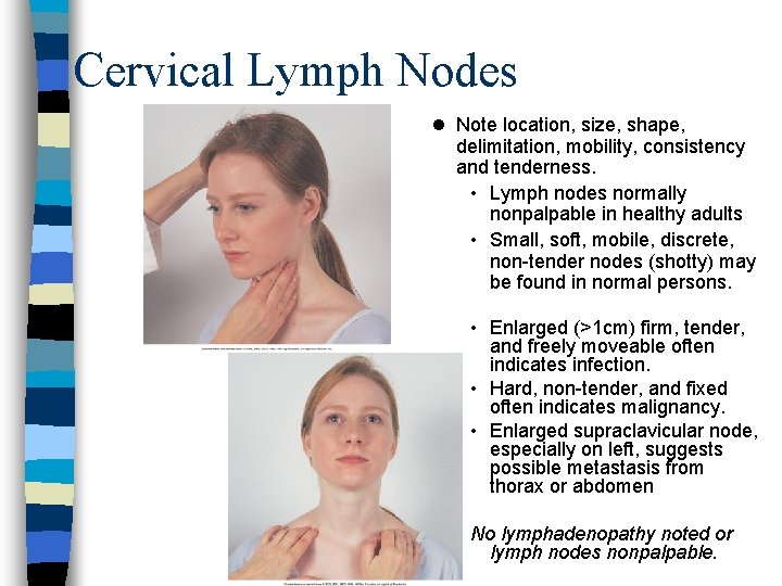 Cervical Lymph Nodes l Note location, size, shape, delimitation, mobility, consistency and tenderness. •