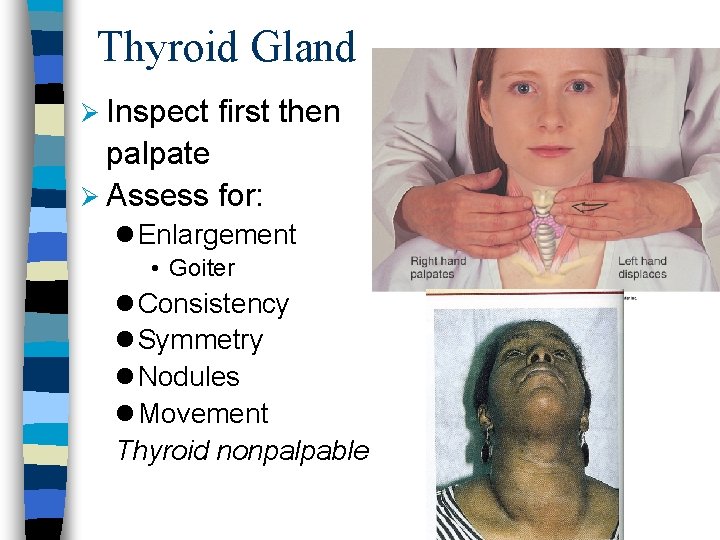 Thyroid Gland Ø Inspect first then palpate Ø Assess for: l Enlargement • Goiter