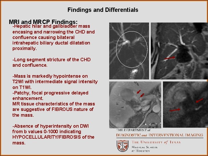 Findings and Differentials MRI and MRCP Findings: -Hepatic hilar and gallbladder mass encasing and