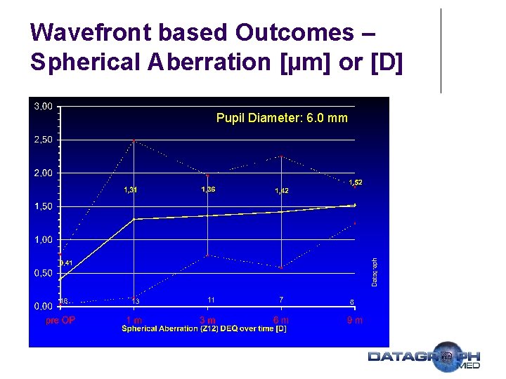 Wavefront based Outcomes – Spherical Aberration [µm] or [D] Pupil Diameter: 6. 0 mm