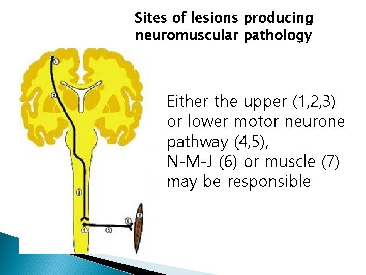 Sites of lesions producing neuromuscular pathology Either the upper (1, 2, 3) or lower Sites of lesions producing neuromuscular pathology Either the upper (1, 2, 3) or lower