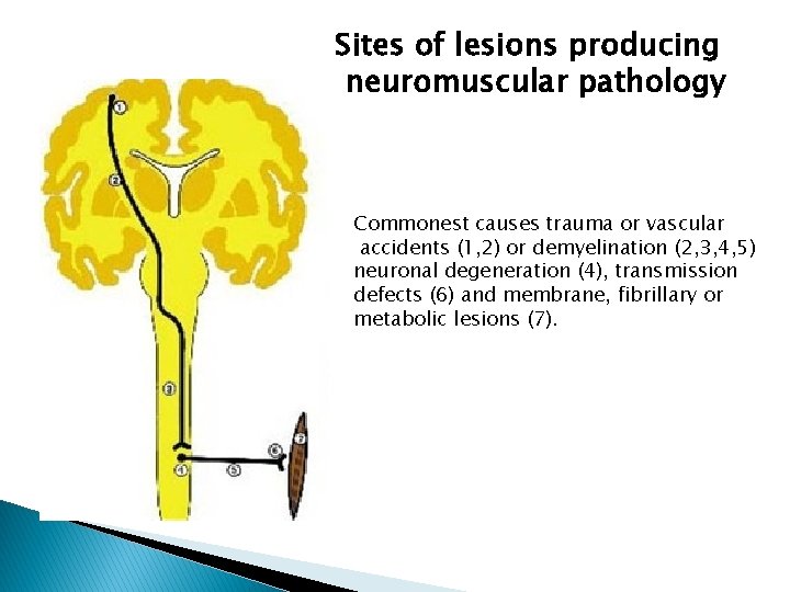 Sites of lesions producing neuromuscular pathology Commonest causes trauma or vascular accidents (1, 2) Sites of lesions producing neuromuscular pathology Commonest causes trauma or vascular accidents (1, 2)