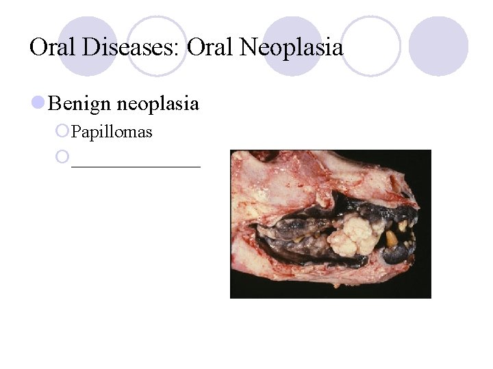 Oral Diseases: Oral Neoplasia l Benign neoplasia ¡Papillomas ¡_______ Oral Diseases: Oral Neoplasia l Benign neoplasia ¡Papillomas ¡_______