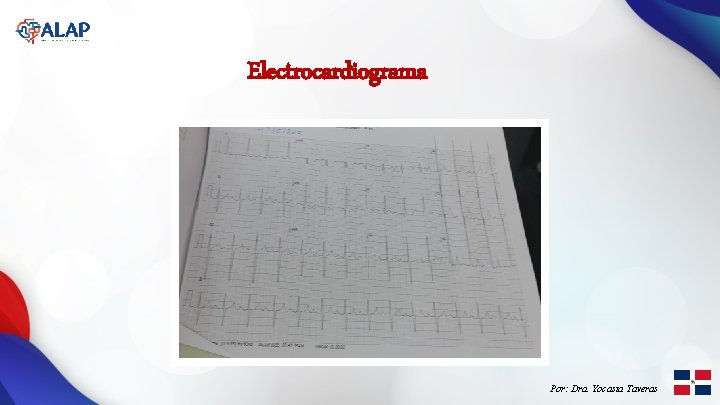 Electrocardiograma Por: Dra. Yocasta Taveras 