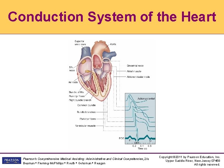 Conduction System of the Heart Pearson's Comprehensive Medical Assisting: Administrative and Clinical Competencies, 2/e