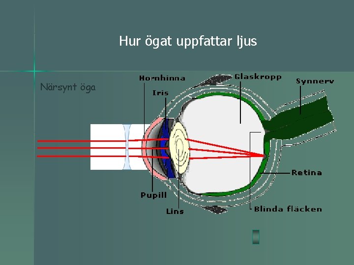 Hur ögat uppfattar ljus Närsynt öga 