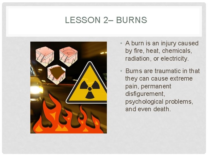 LESSON 2– BURNS • A burn is an injury caused by fire, heat, chemicals,