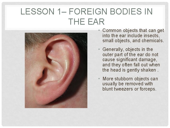 LESSON 1– FOREIGN BODIES IN THE EAR • Common objects that can get into