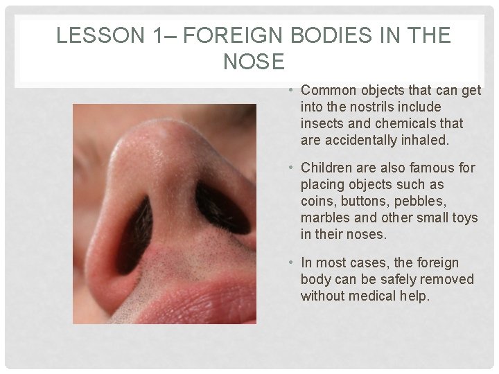 LESSON 1– FOREIGN BODIES IN THE NOSE • Common objects that can get into