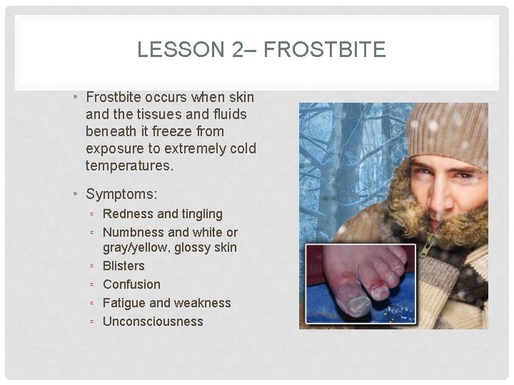 LESSON 2– FROSTBITE • Frostbite occurs when skin and the tissues and fluids beneath