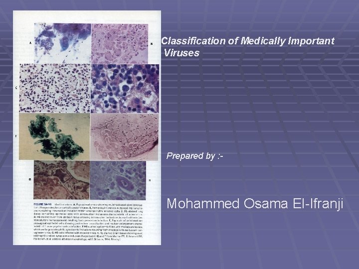 Classification of Medically Important Viruses Prepared by : - Mohammed Osama El-Ifranji 