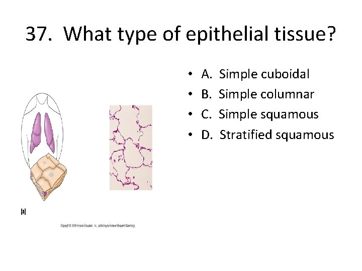 37. What type of epithelial tissue? • • A. B. C. D. Simple cuboidal