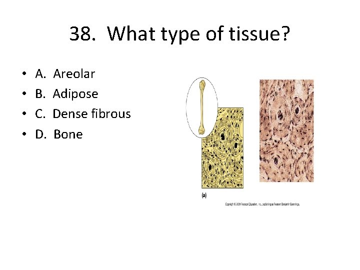 38. What type of tissue? • • A. B. C. D. Areolar Adipose Dense