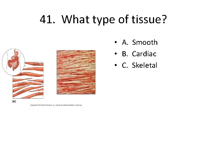 41. What type of tissue? • A. Smooth • B. Cardiac • C. Skeletal