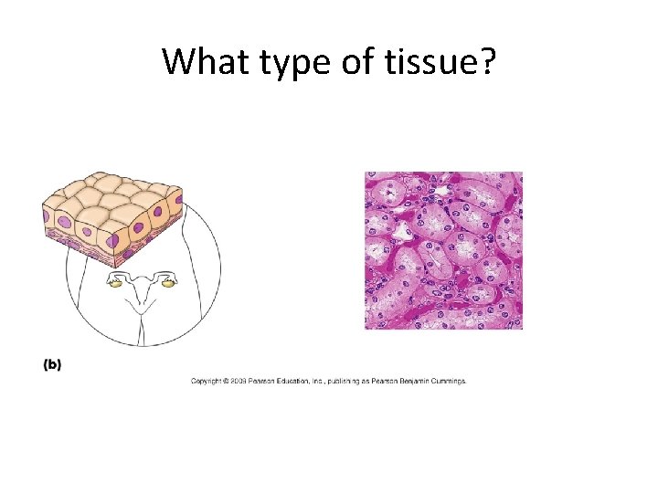 What type of tissue? 