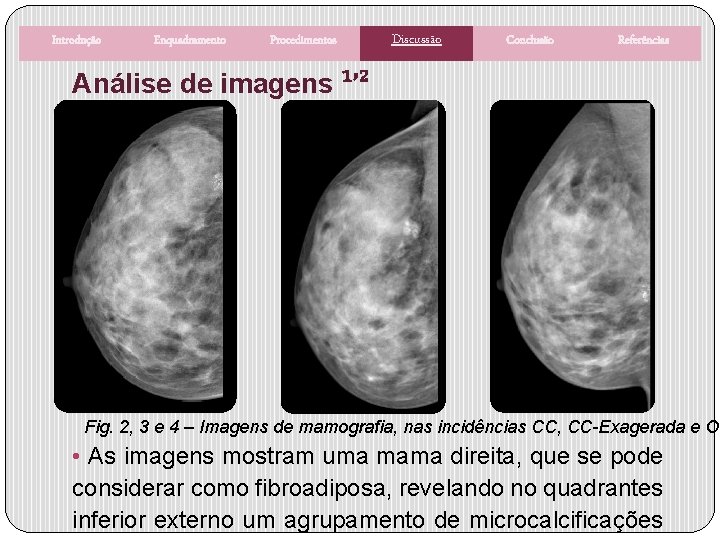 Introdução Enquadramento Procedimentos Discussão Conclusão Referências Análise de imagens ¹’² Fig. 2, 3 e