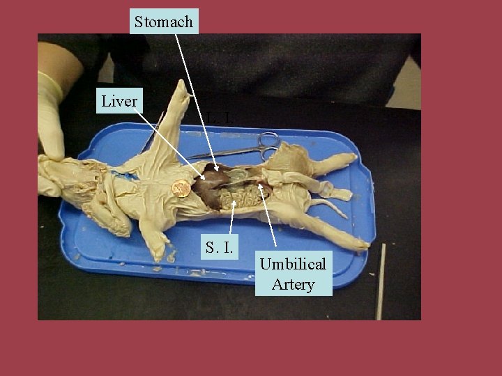 Stomach Liver L. I. S. I. Umbilical Artery 