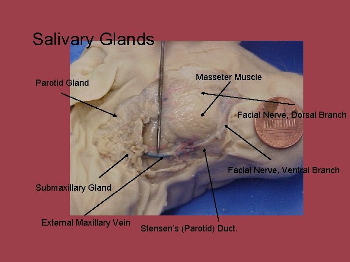 Salivary Glands Parotid Gland Masseter Muscle Facial Nerve, Dorsal Branch Facial Nerve, Ventral Branch