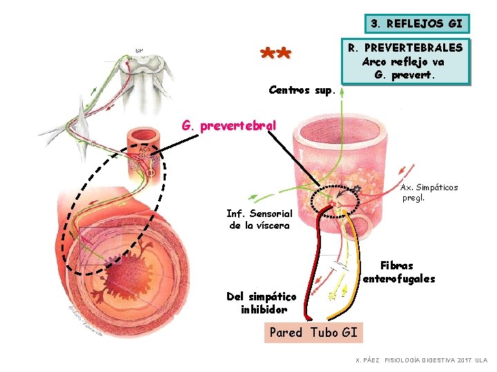 3. REFLEJOS GI ** Centros sup. R. PREVERTEBRALES Arco reflejo va G. prevertebral Ax.
