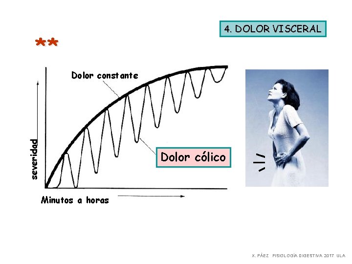 4. DOLOR VISCERAL ** severidad Dolor constante Dolor cólico Minutos a horas X. PÁEZ