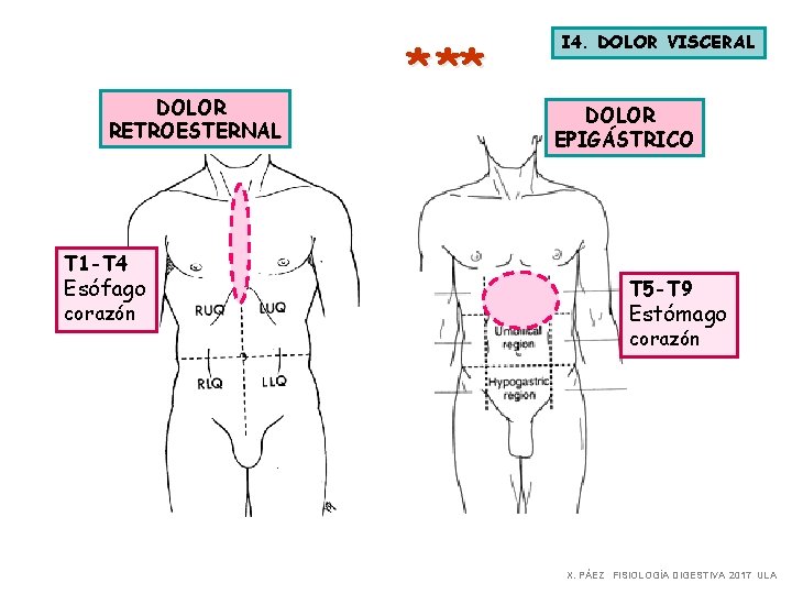 DOLOR RETROESTERNAL T 1 -T 4 Esófago corazón * ** I 4. DOLOR VISCERAL