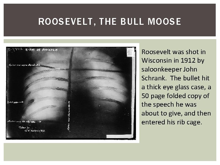 ROOSEVELT, THE BULL MOOSE Roosevelt was shot in Wisconsin in 1912 by saloonkeeper John