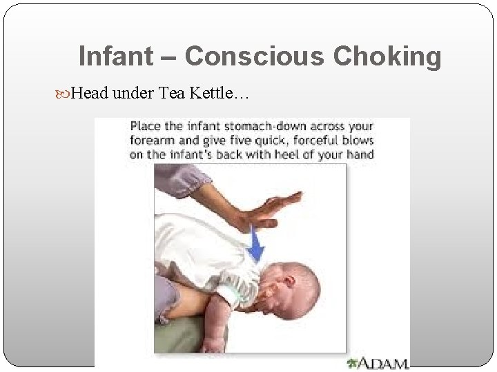 Infant – Conscious Choking Head under Tea Kettle… 