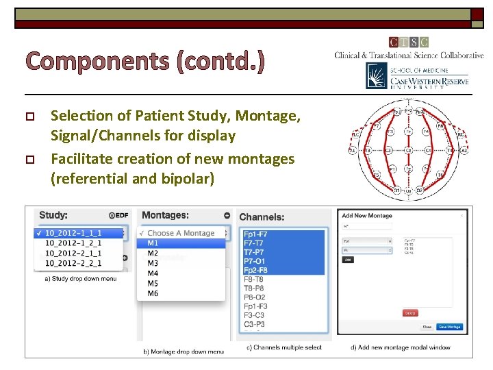 Components (contd. ) o o Selection of Patient Study, Montage, Signal/Channels for display Facilitate