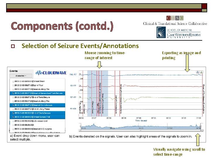 Components (contd. ) o Selection of Seizure Events/Annotations Mouse zooming to timerange of interest