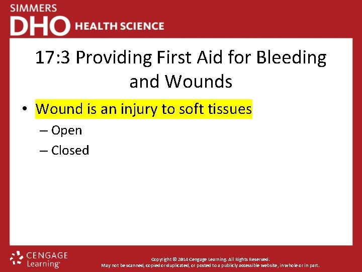 17: 3 Providing First Aid for Bleeding and Wounds • Wound is an injury